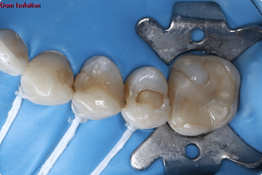 天然歯の機能