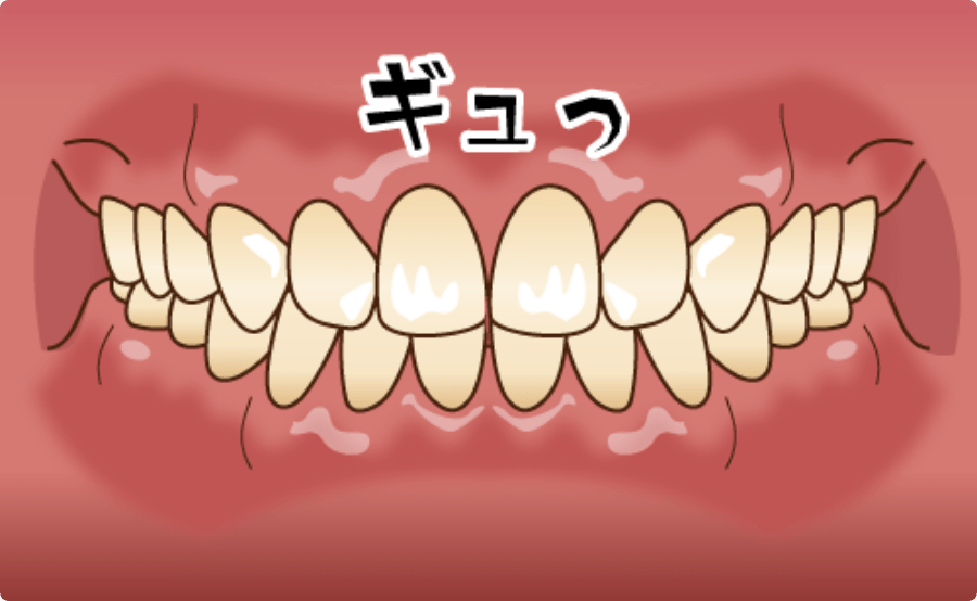 歯周病の初期症状